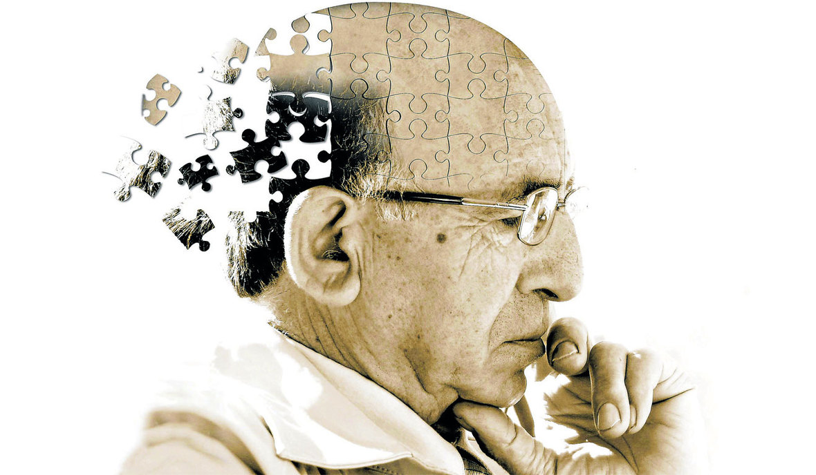 Un nuovo farmaco rallenta la progressione dell’Alzheimer